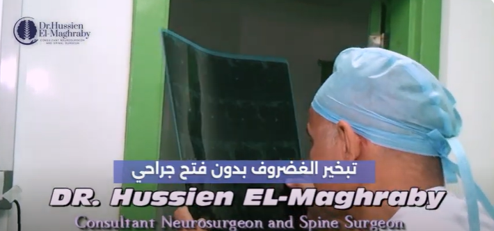 without-surgical-opening